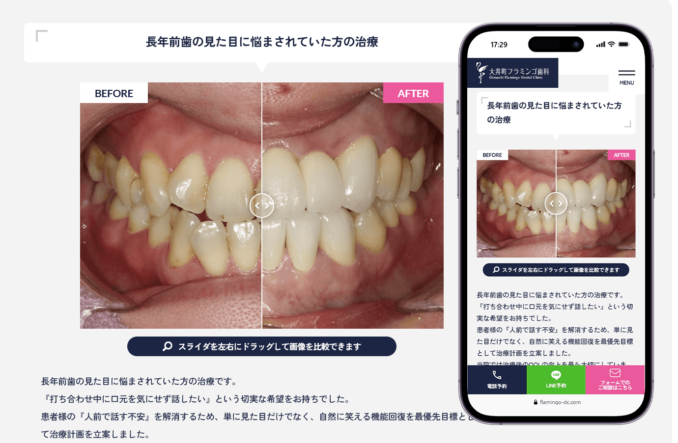 治療実績を分かりやすく伝える症例コンテンツ