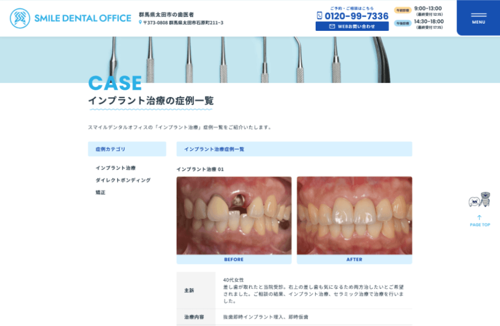 運用しやすい症例コンテンツを構築