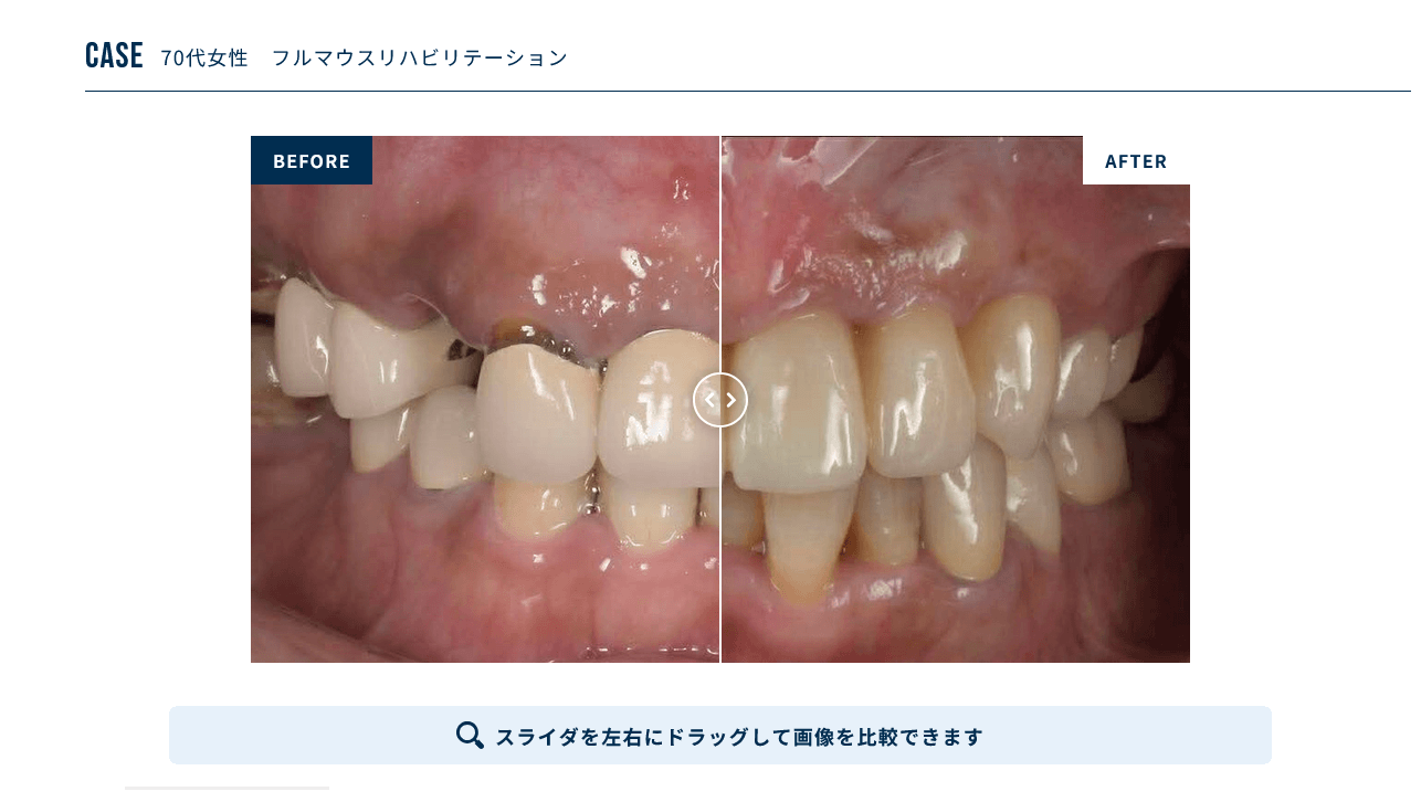 継続的に情報を蓄積できる症例CMS