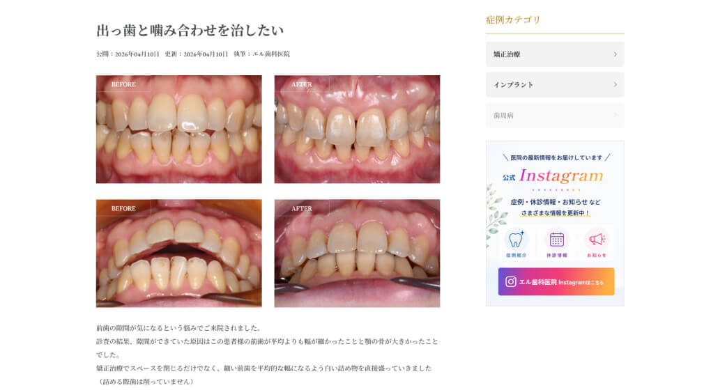 治療をより具体的にイメージできる症例紹介
